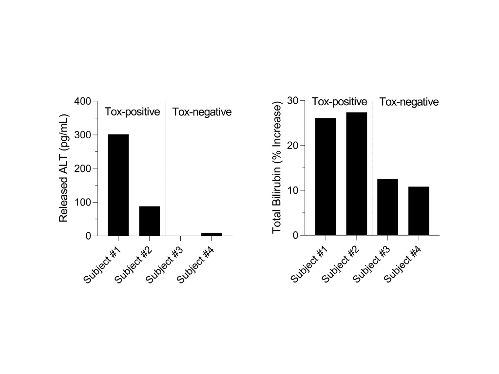 ALT and bilirubin hepatotoxicity biomarkers